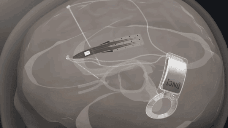 INBRAIN & Microsoft Partner to Develop AI-Powered Brain Interface Tech ...
